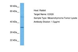 COQ9 Rabbit anti-Human, Polyclonal, Novus Biologicals 0.1 mL | Buy Online | Novus Biologicals | Fisher Scientific